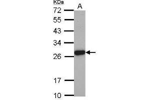 WB Image Sample (30 ug of whole cell lysate) A: PC-3 12% SDS PAGE antibody diluted at 1:2000 (Elastase 3A anticorps)