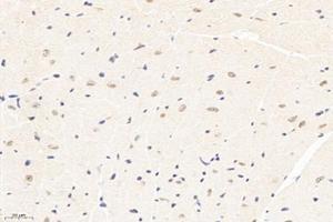 Immunohistochemistry analysis of paraffin-embedded mouse heart using,PPM1G (ABIN7075287) at dilution of 1: 3000 (PPM1G anticorps)