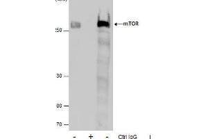 IP Image Immunoprecipitation of mTOR protein from 293T whole cell extracts using 5 μg of mTOR antibody [C3], C-term, Western blot analysis was performed using mTOR antibody [C3], C-term, EasyBlot anti-Rabbit IgG  was used as a secondary reagent.