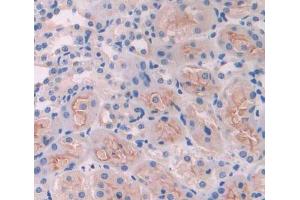 Used in DAB staining on fromalin fixed paraffin- embedded kidney tissue