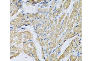 Immunohistochemistry of paraffin-embedded Mouse heart using CRHBP Polyclonal Antibody at dilution of 1:100 (40x lens). (CRHBP anticorps)