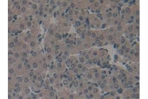 Detection of GSTk1 in Mouse Ovary Tissue using Polyclonal Antibody to Glutathione S Transferase Kappa 1 (GSTk1)