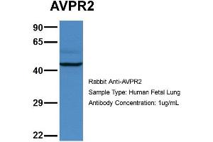 Host: Rabbit  Target Name: AVPR2  Sample Tissue: Human Fetal Lung  Antibody Dilution: 1. (AVPR2 anticorps  (C-Term))