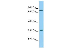 WB Suggested Anti-KLK2 Antibody Titration:  0. (Kallikrein 2 anticorps  (Middle Region))