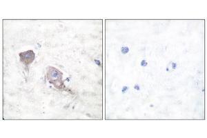 Immunohistochemistry (IHC) image for anti-Synaptosomal-Associated Protein, 25kDa (SNAP25) (C-Term) antibody (ABIN1848775) (SNAP25 anticorps  (C-Term))