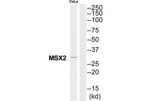 Western Blotting (WB) image for anti-Msh Momeobox 2 (Msx2) (Internal Region) antibody (ABIN1851457) (Msx2/Hox8 anticorps  (Internal Region))