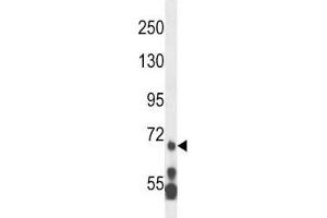 MLL5 antibody western blot analysis in HL-60 lysate.