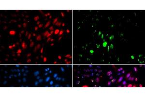 Immunofluorescence analysis of U2OS cells using Phospho-ABL1(Y204) Polyclonal Antibody