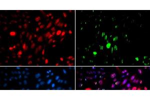 Immunofluorescence analysis of U2OS cells using Phospho-ABL1(Y204) Polyclonal Antibody (ABL1 anticorps  (pTyr204))