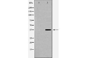 Western blot analysis of extracts of HepG2 , using CFHR1 antibody. (CFHR1 anticorps  (C-Term))
