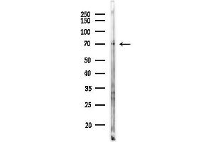 Western blot analysis of lysates from Rat brain, using SLC5 Antibody at 1/1000 dilution.