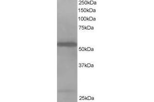 ABIN184747 staining (1µg/ml) of Jurkat lysate (RIPA buffer, 35µg total protein per lane). (DBNL anticorps  (N-Term))