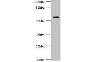 Western blot All lanes: ACBD5 antibody at 2 μg/mL + Hela whole cell lysate Secondary Goat polyclonal to rabbit IgG at 1/10000 dilution Predicted band size: 61, 55, 59, 47 kDa Observed band size: 61 kDa (ACBD5 anticorps  (AA 1-461))