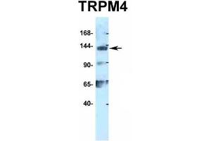 Host:  Rabbit  Target Name:  TRPM4  Sample Type:  293T  Antibody Dilution:  1.