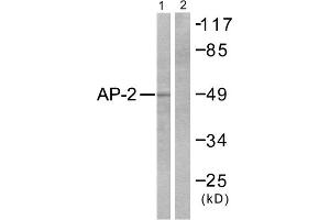 Western blot analysis of extracts from COLO205 cells, using AP-2 antibody. (TFAP2A anticorps  (C-Term))