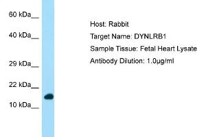 Western Blotting (WB) image for anti-Dynein, Light Chain, Roadblock Type 1 (DYNLRB1) (N-Term) antibody (ABIN2790178)