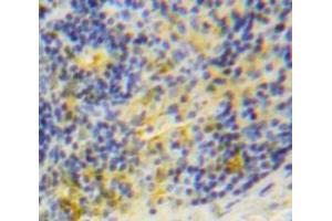 Used in DAB staining on fromalin fixed paraffin-embedded Spleen tissue
