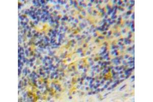 Used in DAB staining on fromalin fixed paraffin-embedded Spleen tissue (TRAF1 anticorps  (AA 169-392))