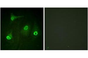 Immunofluorescence analysis of HeLa cells, using NF-kappaB p65 (Acetyl-Lys310) Antibody. (NF-kB p65 anticorps  (acLys310))