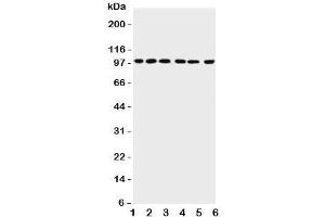Western blot testing of PIAS1 antibody and Lane 1:  rat testis;  2: mouse testis;  3: human HeLa;  4: (h) Jurkat;  5: (h) MCF-7;  6: (h) SKOV lysate;  Expected size: 72~100KD