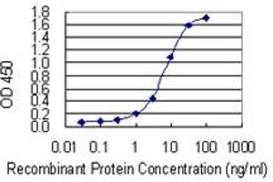 Detection limit for recombinant GST tagged FOXP1 is 0.