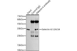 Immunoprecipitation analysis of 300 μg extracts of HT-29 cells using 3 μg Galectin 4/LG antibody (ABIN1679347, ABIN3017979, ABIN3017980 and ABIN7101554).