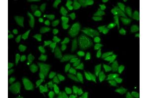 Immunofluorescence analysis of HeLa cells using ALDH2 antibody.