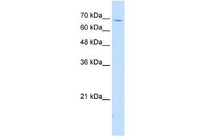 WB Suggested Anti-IL18RAP Antibody Titration:  2. (IL18RAP anticorps  (N-Term))