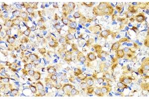 Immunohistochemistry of paraffin-embedded Rat ovary using BMPR1B Polyclonal Antibody at dilution of 1:200 (40x lens).
