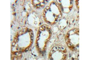 Used in DAB staining on fromalin fixed paraffin-embedded Kidney tissue (TNFRSF12A anticorps  (AA 24-126))