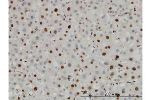 Immunoperoxidase of monoclonal antibody to H3F3B on formalin-fixed paraffin-embedded human liver.