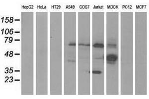 Image no. 1 for anti-Kelch-Like 2, Mayven (KLHL2) (AA 1-100), (AA 494-593) antibody (ABIN1490547) (KLHL2 anticorps  (AA 1-100, AA 494-593))