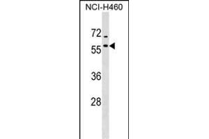DNAJA4 Antibody (C-term) (ABIN1536998 and ABIN2849123) western blot analysis in NCI- cell line lysates (35 μg/lane). (DNAJA4 anticorps  (C-Term))