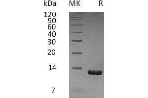 Chemokine (C-C Motif) Ligand 8 (CCL8) protein (His tag)