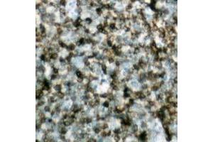 Immunohistochemical analysis of BCL2 staining in human lymph node formalin fixed paraffin embedded tissue section.