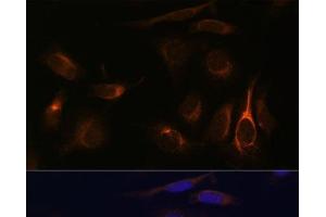 Immunofluorescence analysis of U-2 OS cells using VMP1 Polyclonal Antibody at dilution of 1:100 (40x lens). (VMP1 anticorps)