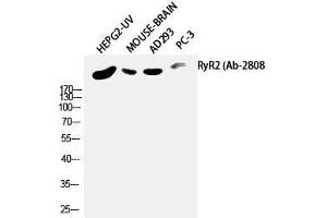 Western Blot analysis of HepG2-UV, Mouse brain, AD293T, PC-3 using RYR2 Polyclonal Antibody at dilution of 1:2000. (RYR2 anticorps)