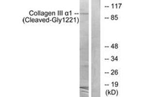 Western blot analysis of extracts from A549 cells, treated with etoposide 25uM 24h, using Collagen III alpha1 (Cleaved-Gly1221) Antibody. (COL3A1 anticorps  (Cleaved-Gly1221))