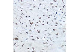 anti-Serine/arginine Repetitive Matrix 1 (SRRM1) (AA 1-160) antibody