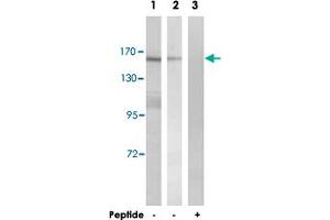 Western blot analysis of extracts from K-562 cells (Lane 1 and lane 3) and HT-29 cells (Lane 2), using MLH3 polyclonal antibody . (MLH3 anticorps)