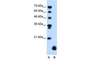 Image no. 1 for anti-Proteolipid Protein 2 (PLP2) (C-Term) antibody (ABIN205077) (PLP2 anticorps  (C-Term))
