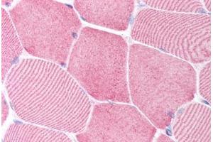 Human Skeletal Muscle (formalin-fixed, paraffin-embedded) stained with CASP6 antibody ABIN213918 at 5 ug/ml followed by biotinylated goat anti-rabbit IgG secondary antibody ABIN481713, alkaline phosphatase-streptavidin and chromogen. (Caspase 6 anticorps  (N-Term))