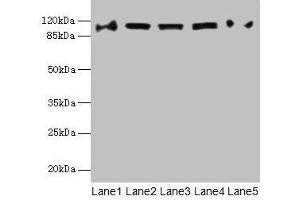 Western blot All lanes: COPB1 antibody at 1 μg/mL Lane 1: Hela whole cell lysate Lane 2: Jurkat whole cell lysate Lane 3: NIH/3T3 whole cell lysate Lane 4: Mouse liver tissue Lane 5: A549 whole cell lysate Secondary Goat polyclonal to rabbit IgG at 1/10000 dilution Predicted band size: 108 kDa Observed band size: 108 kDa (COPB1 anticorps  (AA 2-200))