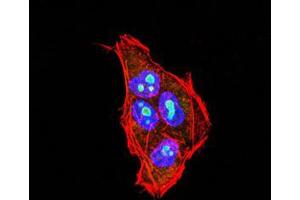 Immunohistochemical analysis of paraffin-embedded Hela tissues using PLCG2 mouse mAb with DAB staining.