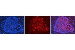 Rabbit Anti-HMOX1 Antibody   Formalin Fixed Paraffin Embedded Tissue: Human Ovary Tissue Observed Staining: Cytoplasm Primary Antibody Concentration: 1:100 Other Working Concentrations: 1:600 Secondary Antibody: Donkey anti-Rabbit-Cy3 Secondary Antibody Concentration: 1:200 Magnification: 20X Exposure Time: 0.
