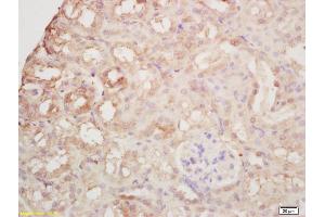 Formalin-fixed and paraffin embedded mouse kidney labeled with Rabbit Anti Arginase II Polyclonal Antibody, Unconjugated (ABIN1387473) at 1:200 followed by conjugation to the secondary antibody and DAB staining (ARG2 anticorps  (AA 181-290))