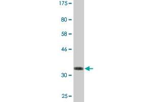 Western Blot detection against Immunogen (36. (BFAR anticorps  (AA 101-200))