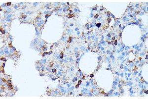 Immunohistochemistry of paraffin-embedded Rat lung using CXCR1 Polyclonal Antibody at dilution of 1:100 (40x lens). (CXCR1 anticorps)