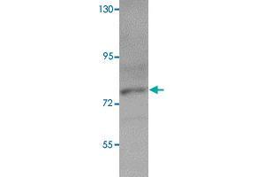 Western blot analysis of K-562 cells with PIAS3 polyclonal antibody  at 1 ug/mL dilution. (PIAS3 anticorps  (C-Term))
