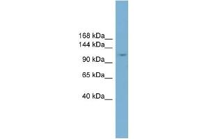 WB Suggested Anti-TRIM37 Antibody Titration:  0. (TRIM37 anticorps  (Middle Region))